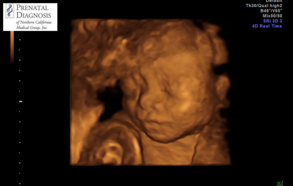 Our 1st glimpse of our baby girl's face!